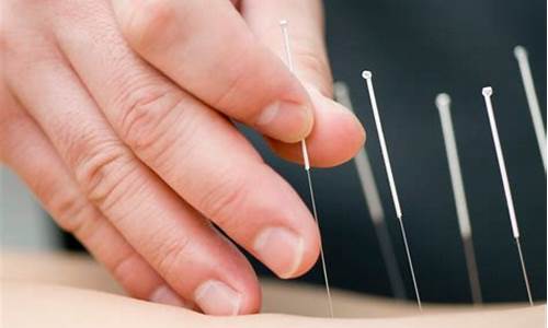 acupuncture_acupuncture品牌